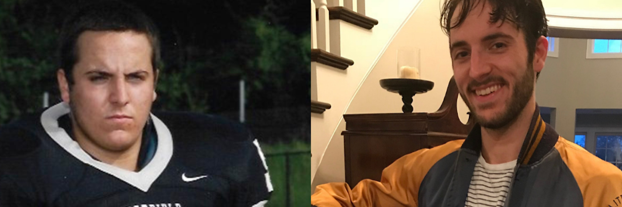 Why I Ignored My Pain as a Man With Crohn's Disease A split screen of the author. On the left, he is a young boy wearing a football uniform with a serious expression on his face. On the right, he is older and smiling.