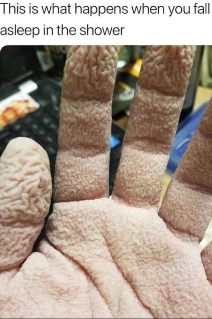 this is what happens when you fall asleep in the shower: person with very wrinkled hands