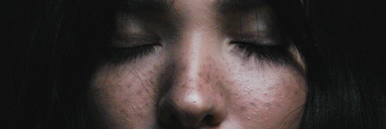 Myths and Facts About Schizophrenia close up photo of dark haired woman with eyes closed and hands raised to neck