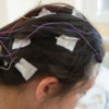 Girl with EEG electrodes attached to her head.