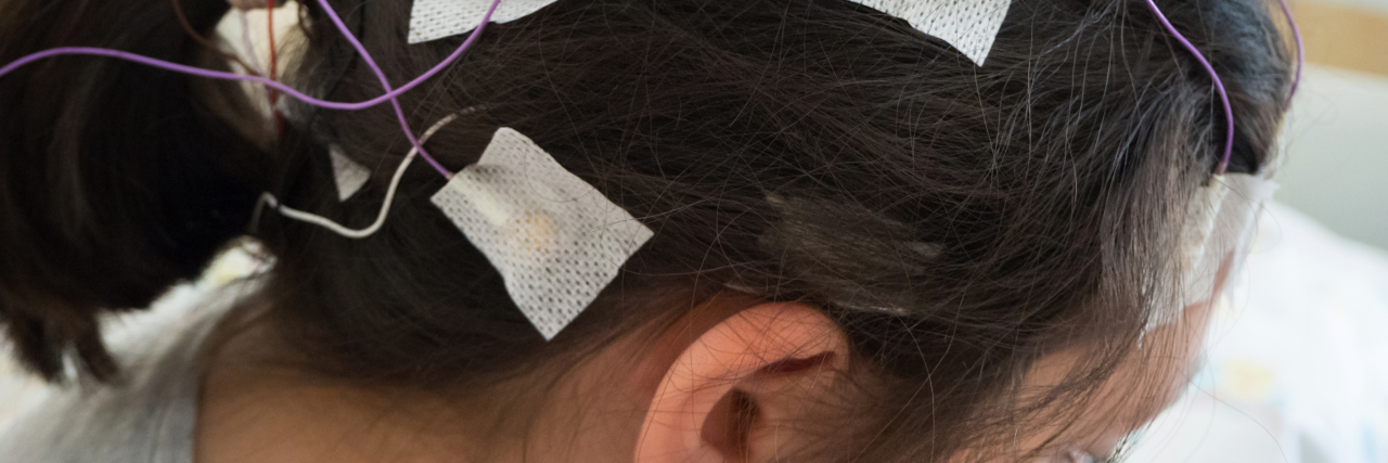 Girl with EEG electrodes attached to her head.