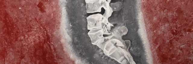 Painting of a spine by Tracy Coval.