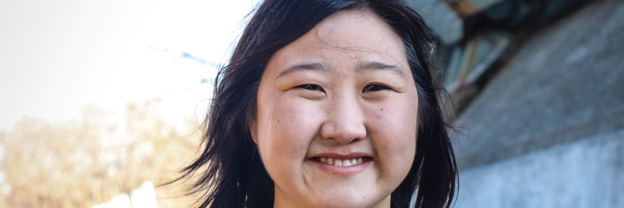 Responding to Judgment About Hair Loss as a Woman With Alopecia Areata Sarah holding a photo of her scalp when she was balding due to alopecia areata.