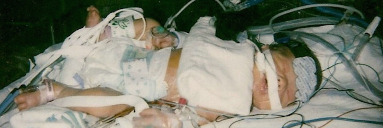 a baby in the cardiac intensive care unit.