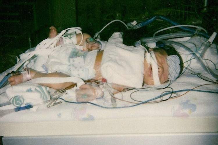 a baby in the cardiac intensive care unit.
