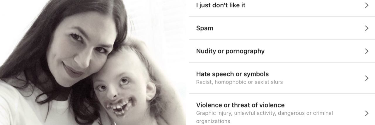 Mom Asks Instagram to Change Policies For Disability Hate Speech Black and white image of Natalie and Sophie Weaver and screenshot of Instagram options when reporting a comment