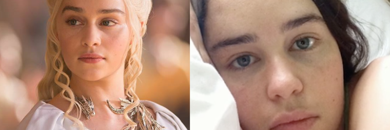 left: Emilia Clarke as Daenerys Targaryen from Game of Thrones. right: Emilia Clarke in the hospital