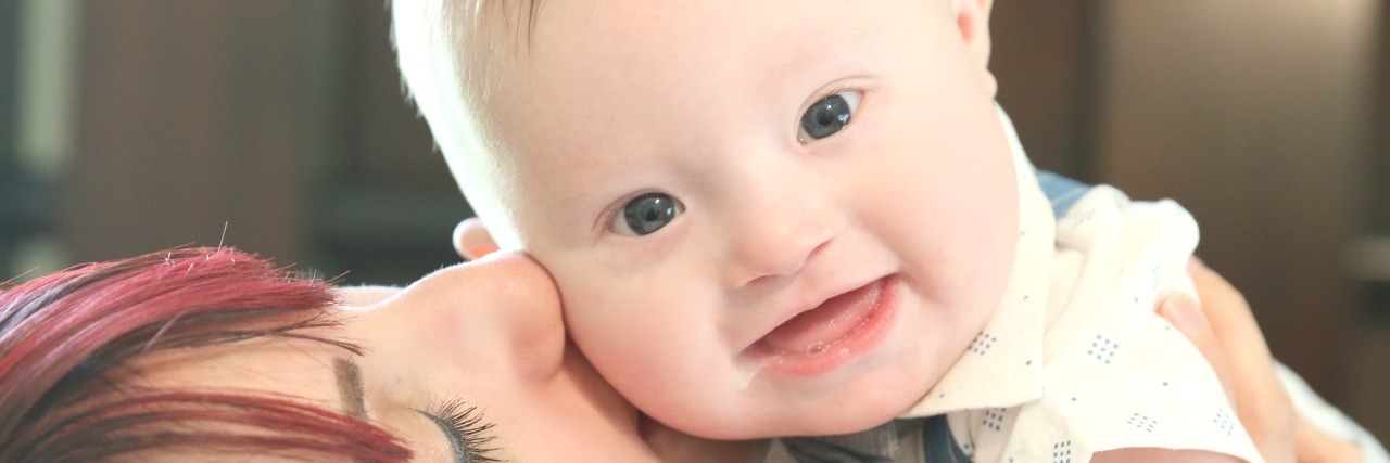 Surprise, Your Baby Boy Has Down Syndrome! Mom kissing adorable baby boy with Down syndrome who is smiling at the camera