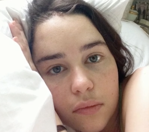 Emilia Clarke lying in her hospital bed