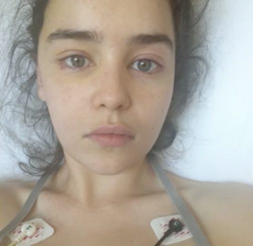 Emilia Clarke lying in her hospital bed with electrodes stuck on her chest