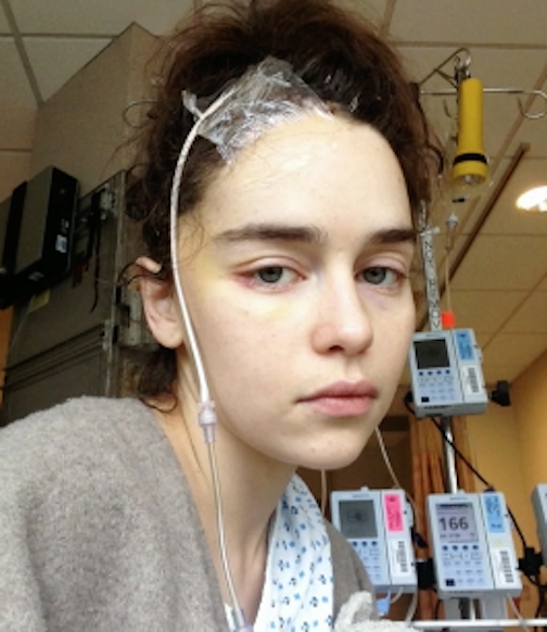Emilia Clarke in the hospital with monitors stuck to her head and a machine behind her