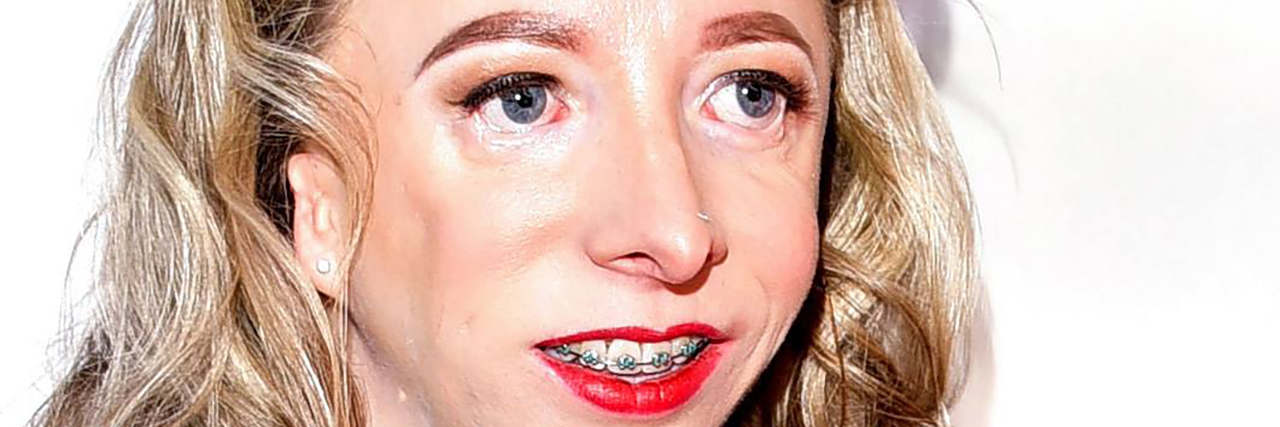 Modeling With a Craniofacial Disability