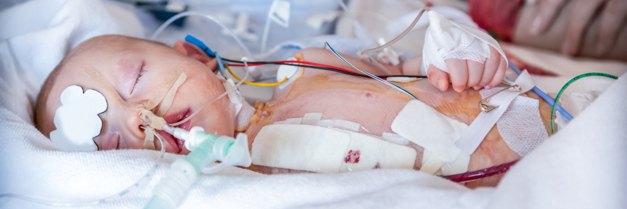 When Surgery Becomes Your 'Normal'