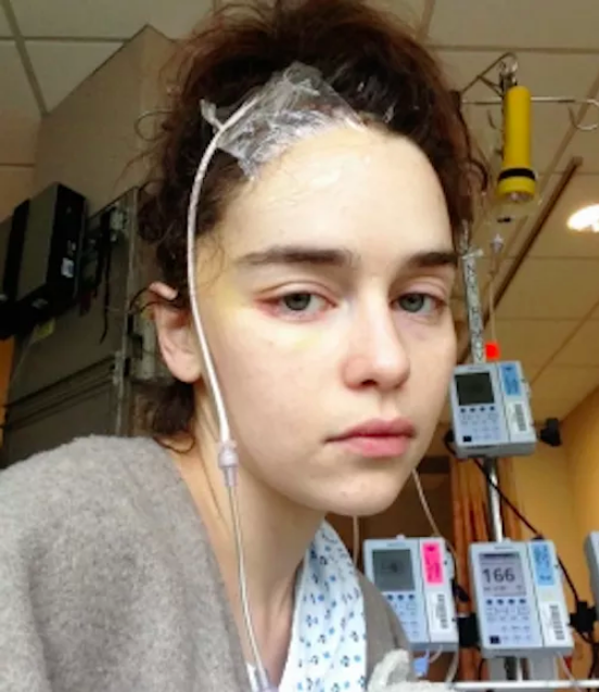 Emilia Clarke in the hospital for surgery after brain aneurysm