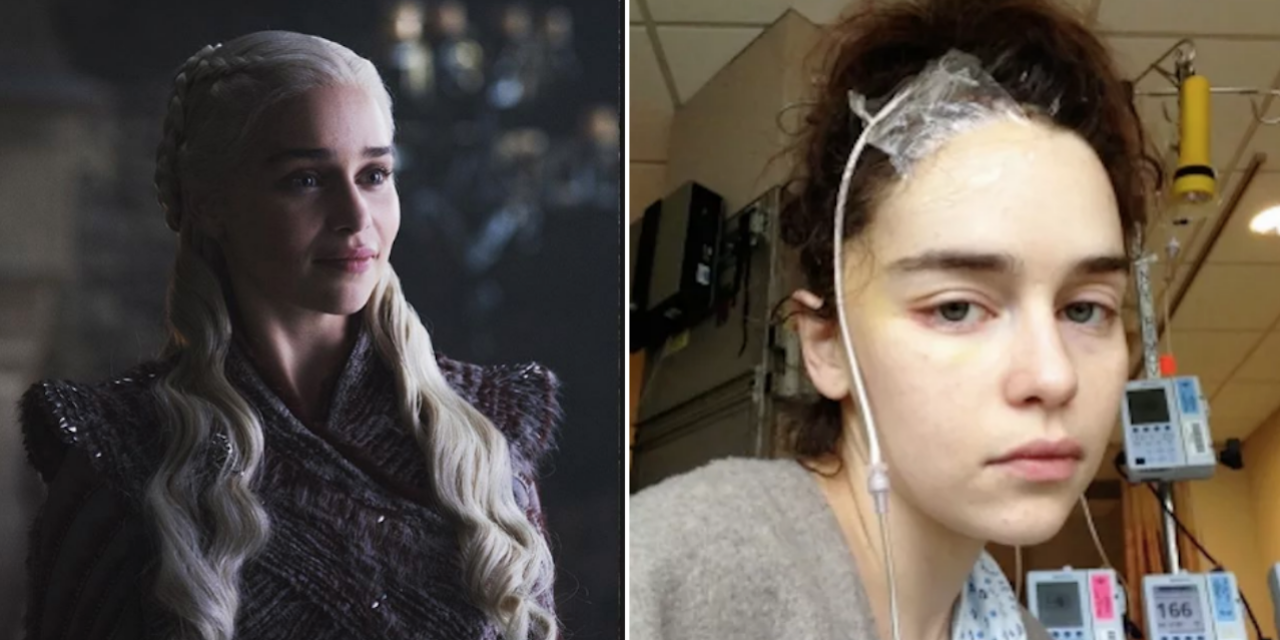 Emilia Clarke Says She Felt ‘unattractive After Her Brain Surgery 