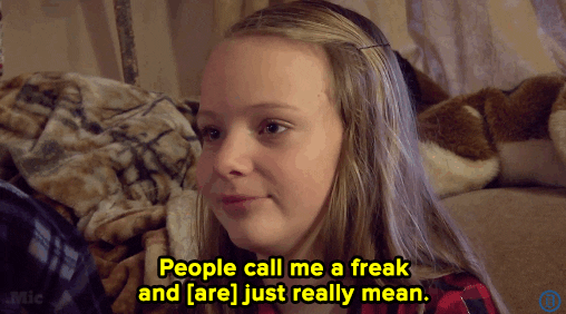 "People call me a freak and are just really mean."