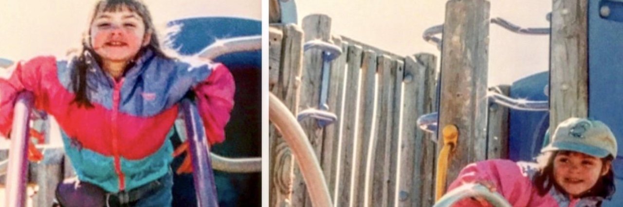 What It's Like to Grow Up With Congenital Heart Disease little girl with CHD on the playground