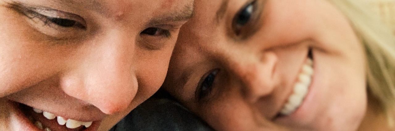 If Your Worry Your Baby With Down Syndrome Will 'Affect' Siblings Sister resting her head on her brother's shoulder