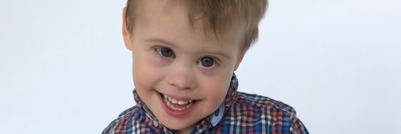 The 'Options' You Have When Your Baby Is Diagnosed With Down Syndrome