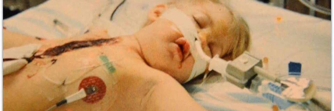 The Traumatic Impact of Complex Congenital Heart Defect Surgery The author as a child, laying on a hospital bed with tubes coming out of her body