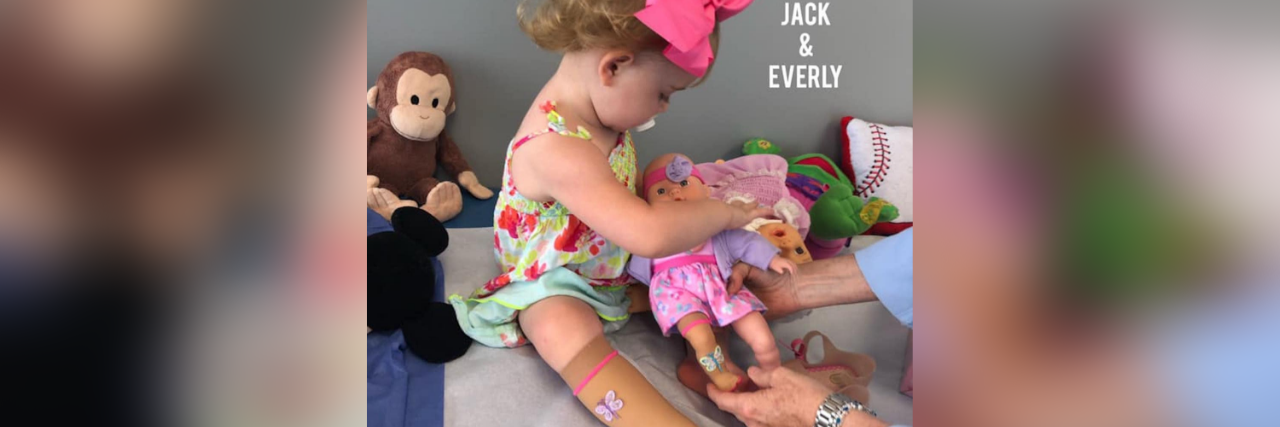 Little girl wearing compression sock and looking at doll wearing matching sock