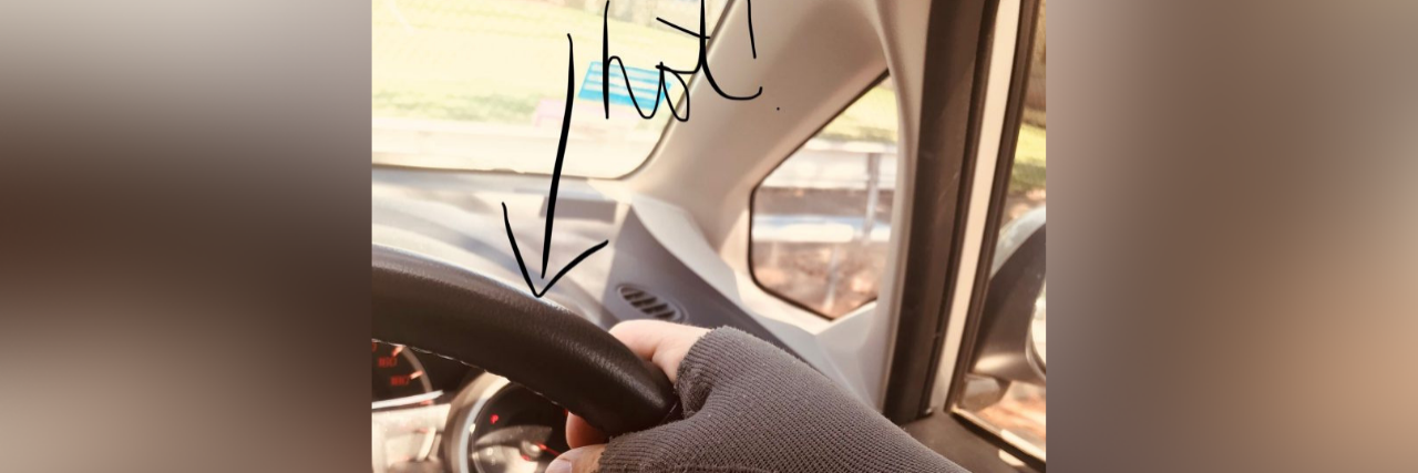 The Benefits of Lymphedema