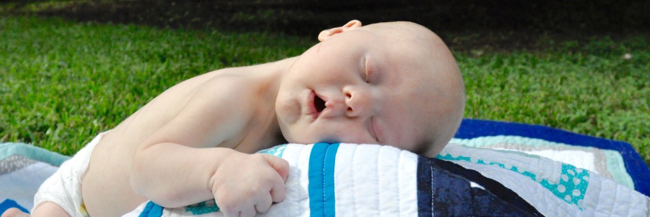 Baby with Down syndrome sleeping outdoors on blanket