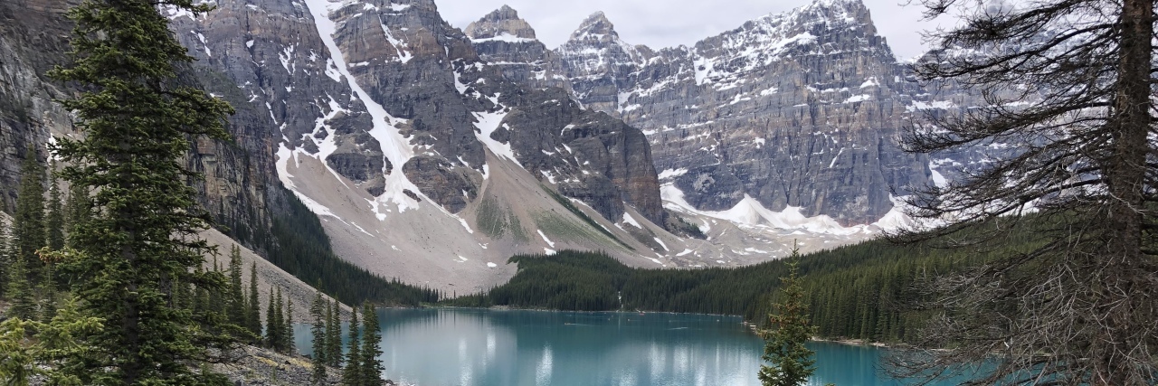 Finding Joy Despite Struggling With Hereditary Inclusion Body Myopathy Jennifer enjoying the Canadian Rockies.