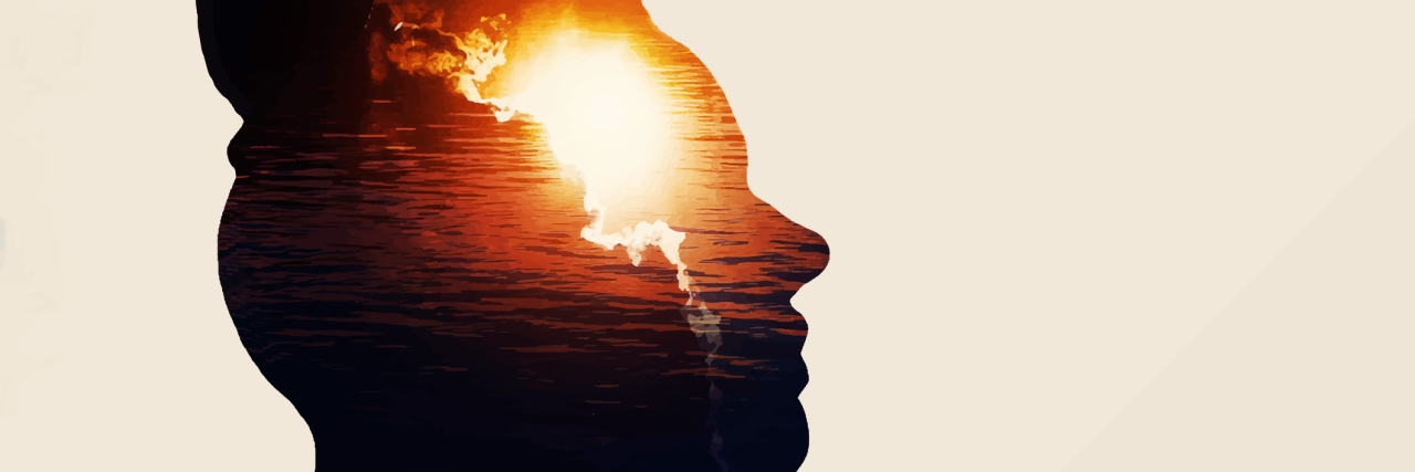 How I Learned to Live Beyond the Challenges of Conversion Disorder