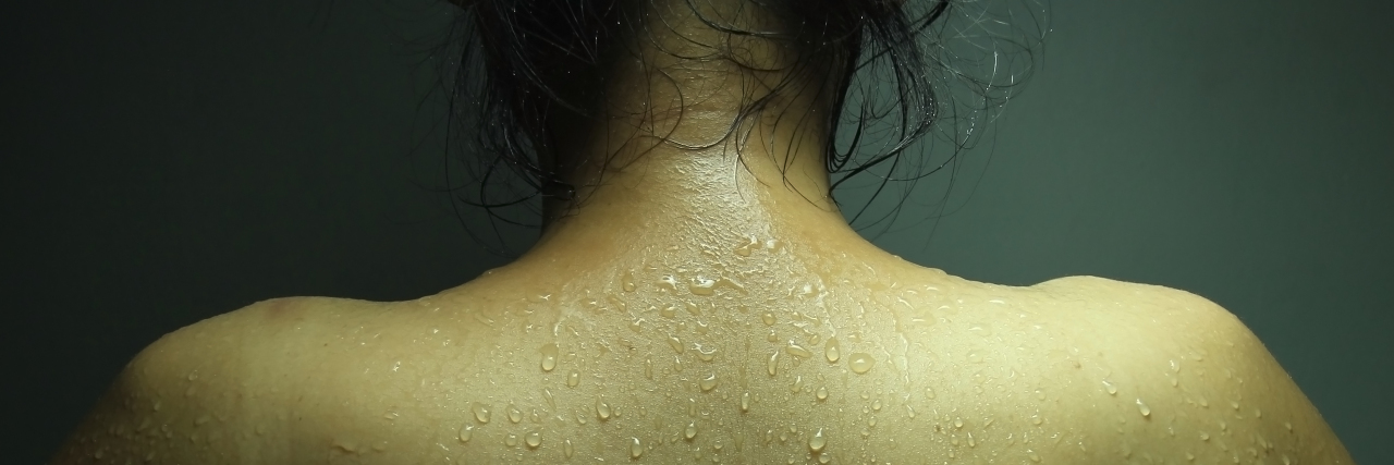What to Know About Living With Hyperhidrosis, or Excessive Sweating photo of a woman's back with beads of sweat visible