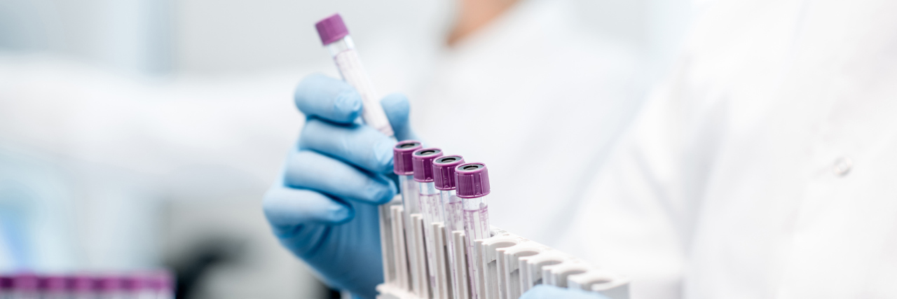 3 New Studies That Will Make You Feel Hopeful About Alzheimer's Laboratory assistant putting test tubes into the holder, Close-up view focused on the tubes