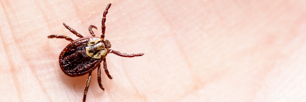 Fear of Tick-Borne Illness After Having Lyme Disease Tick on skin.