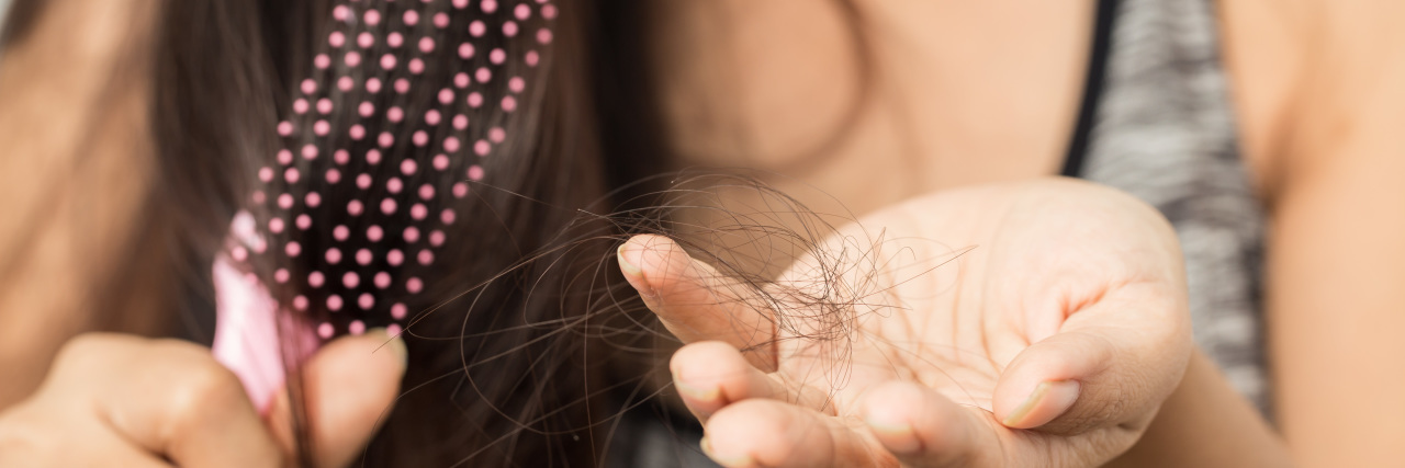 Coping With Hair Loss as a Woman With Chronic Illness Woman holding lost hair in hand.