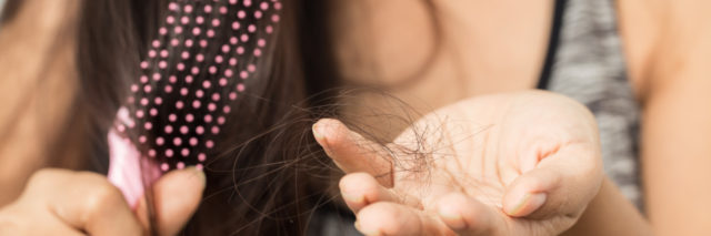 Woman holding lost hair in hand.