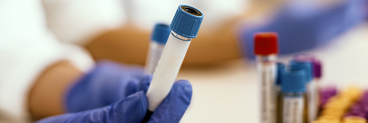 Working With Blood Samples in Laboratory, Closeup. Hand of a Lab Technician Holding Blood Tube. Science, Chemistry, Biology, Medicine and People Concept