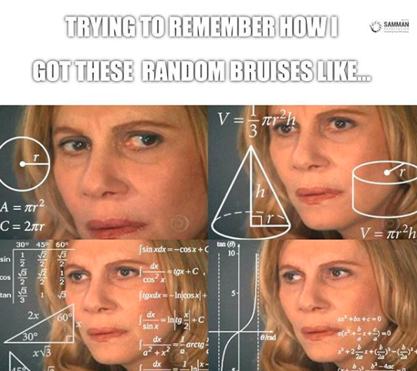 meme of woman trying to do math problems. caption trying to remember how i got these random bruises