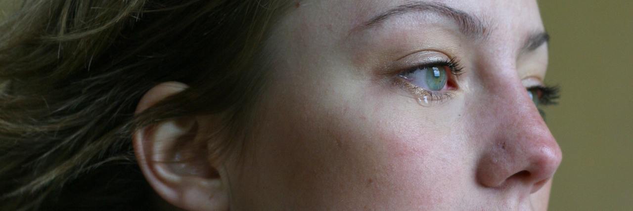 Insurance Company Makes Getting Treatment for Lymphedema Difficult photo of woman crying red eyes