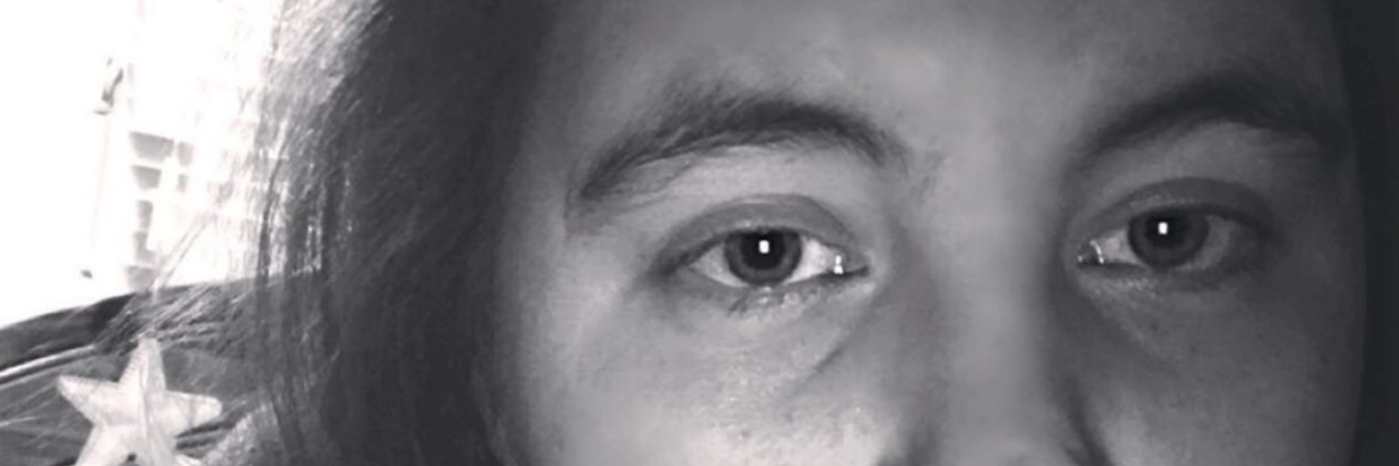 Bipolar Disorder: What's It's Like to Be Manic and Unable to Sleep A black and white selfie of the author