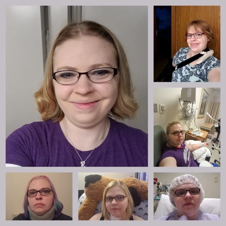 woman with short blonde hair different photos of chronic illness