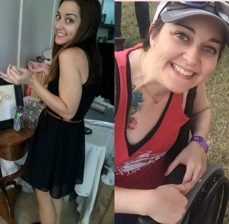 woman's before and after photo standing then sitting