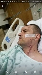 man in hospital with scars on face and neck
