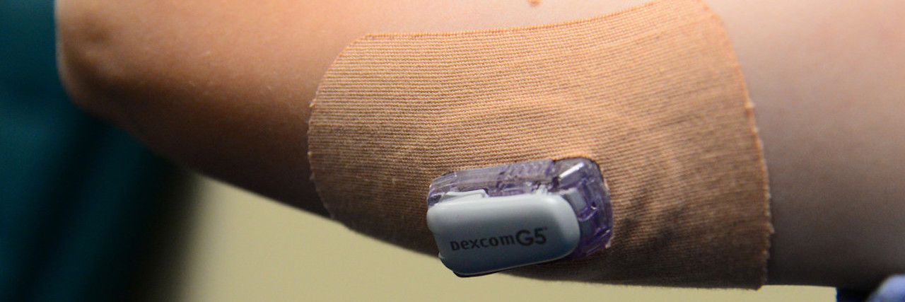 Dexcom continuous glucose monitor