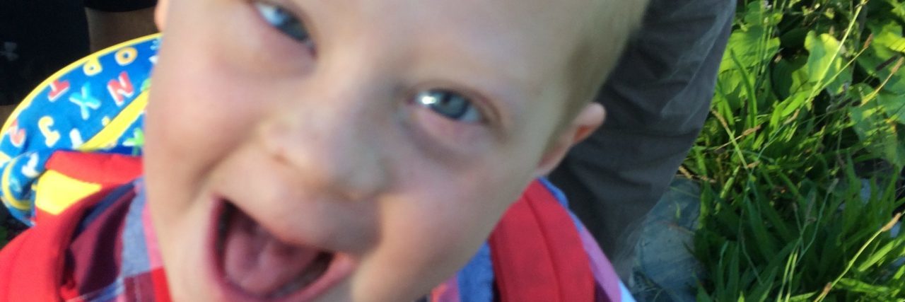 It's OK for Your Kids to Ask About My Child With Down Syndrome Beth's son making a goofy happy face.