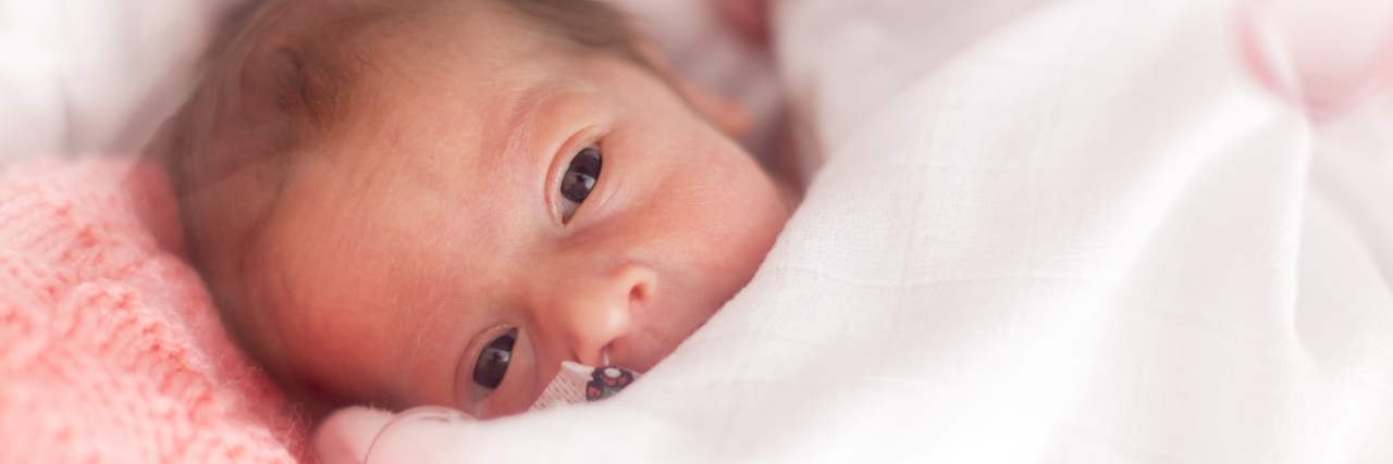 We Need to Talk About the Long-Term Needs of NICU Children Premature baby in NICU.
