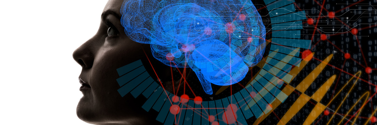 When a Doctor Dismissed My Seizures as 'Anxiety' Woman art with symbols emanating from brain.