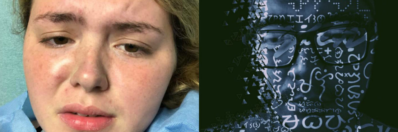 13 Photos That Show the Aftermath of Losing a Friend When You Have BPD woman crying next to photo of man with words superimposed over face