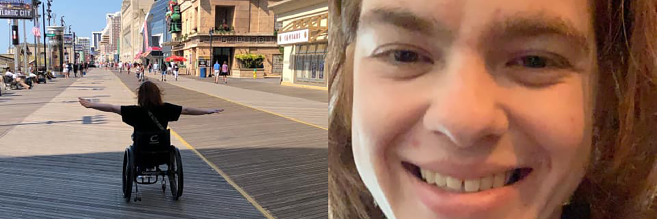 Should I Show or Hide My Disability in Profile Pictures?