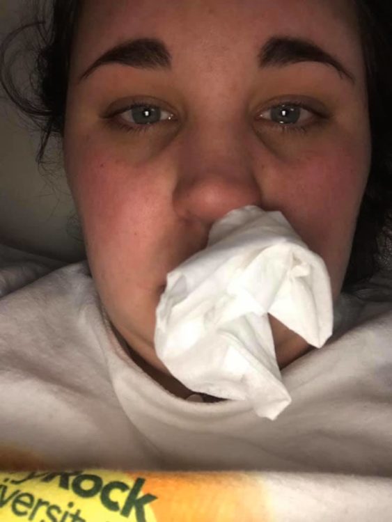 woman with tissue in nose