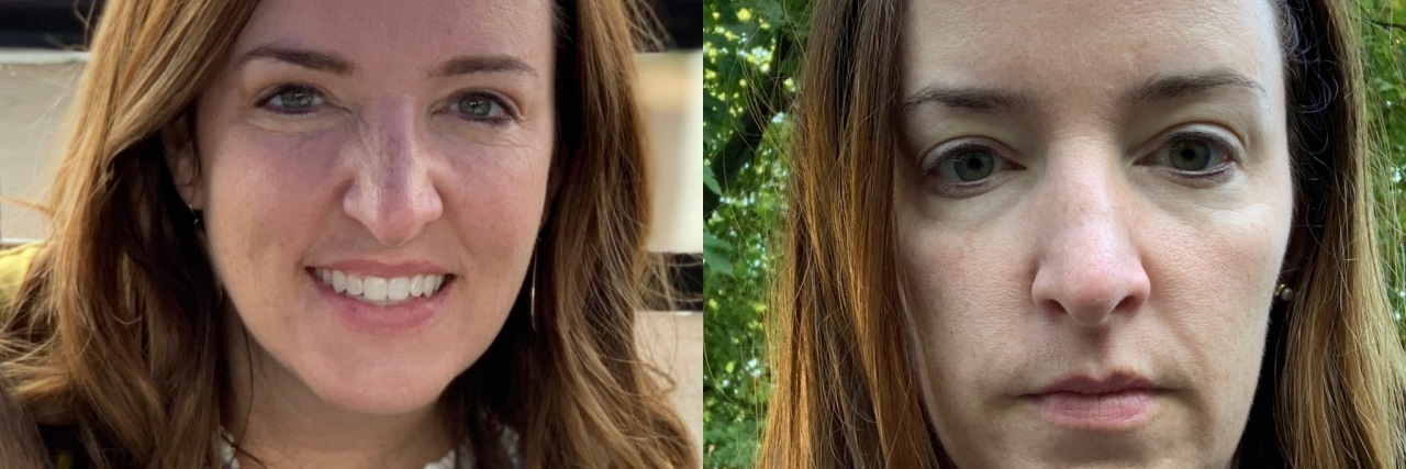 How Traumatic Loss and the Weight of Grief Change You The two photos show the contrast of the author looking happy and healthy on the left, and grieving and tired on the right.