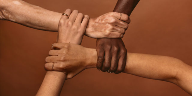 A group of people holding on to each other in a circle.